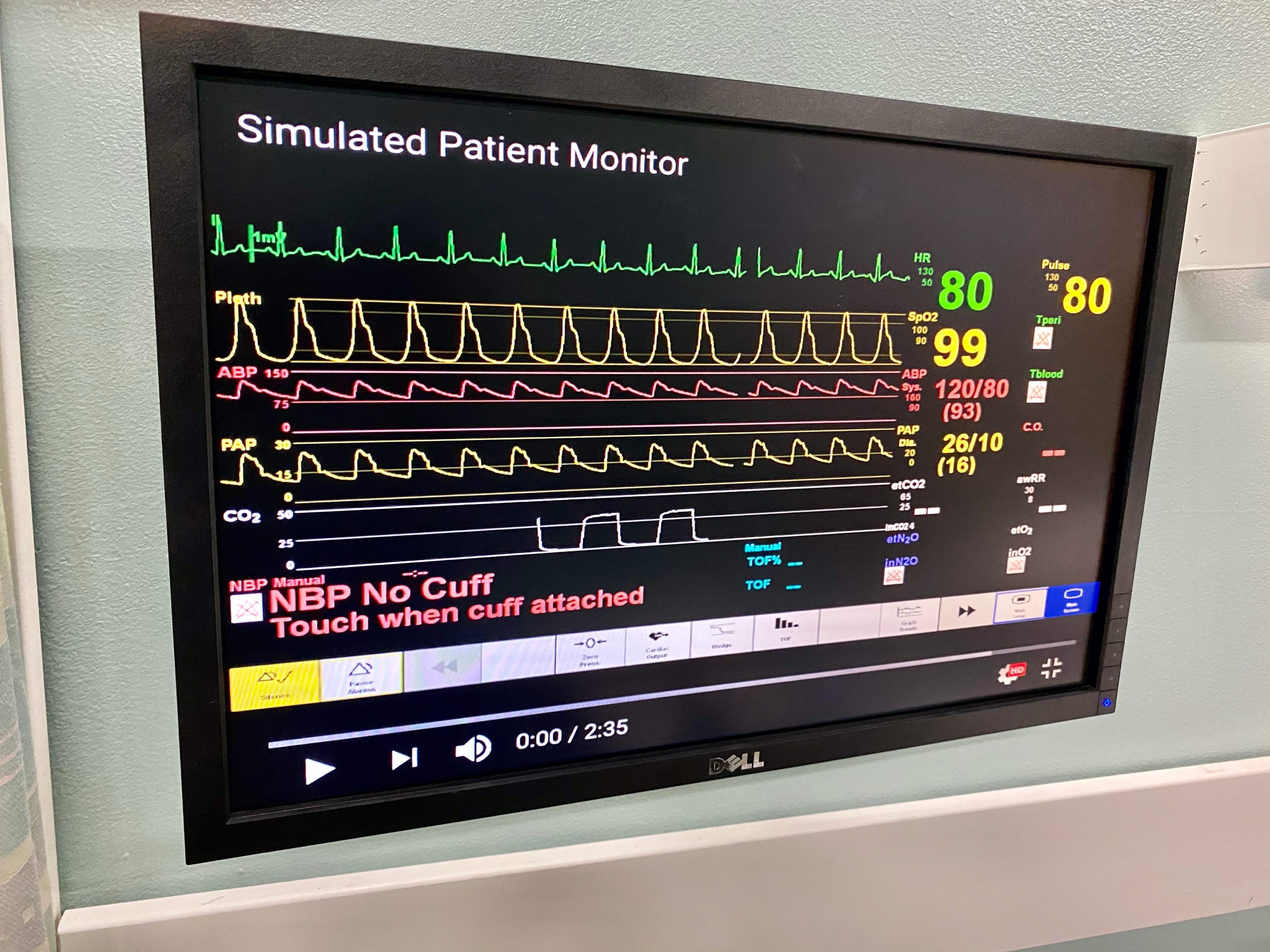 A simulated patient monitor displaying various vital signs and waveforms, including heart rate and blood pressure readings.