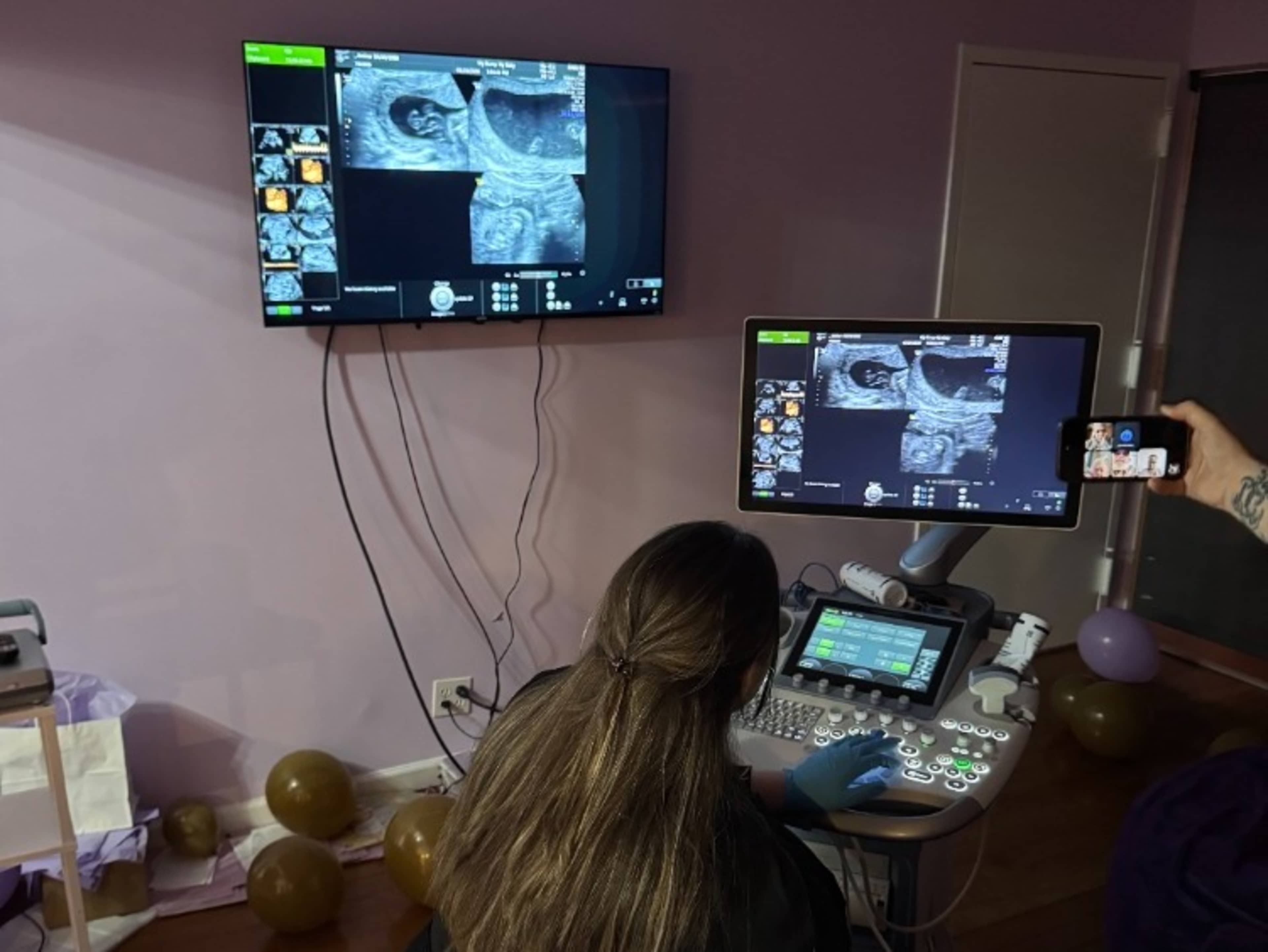 Gender reveal/Baby Shower Sonogram