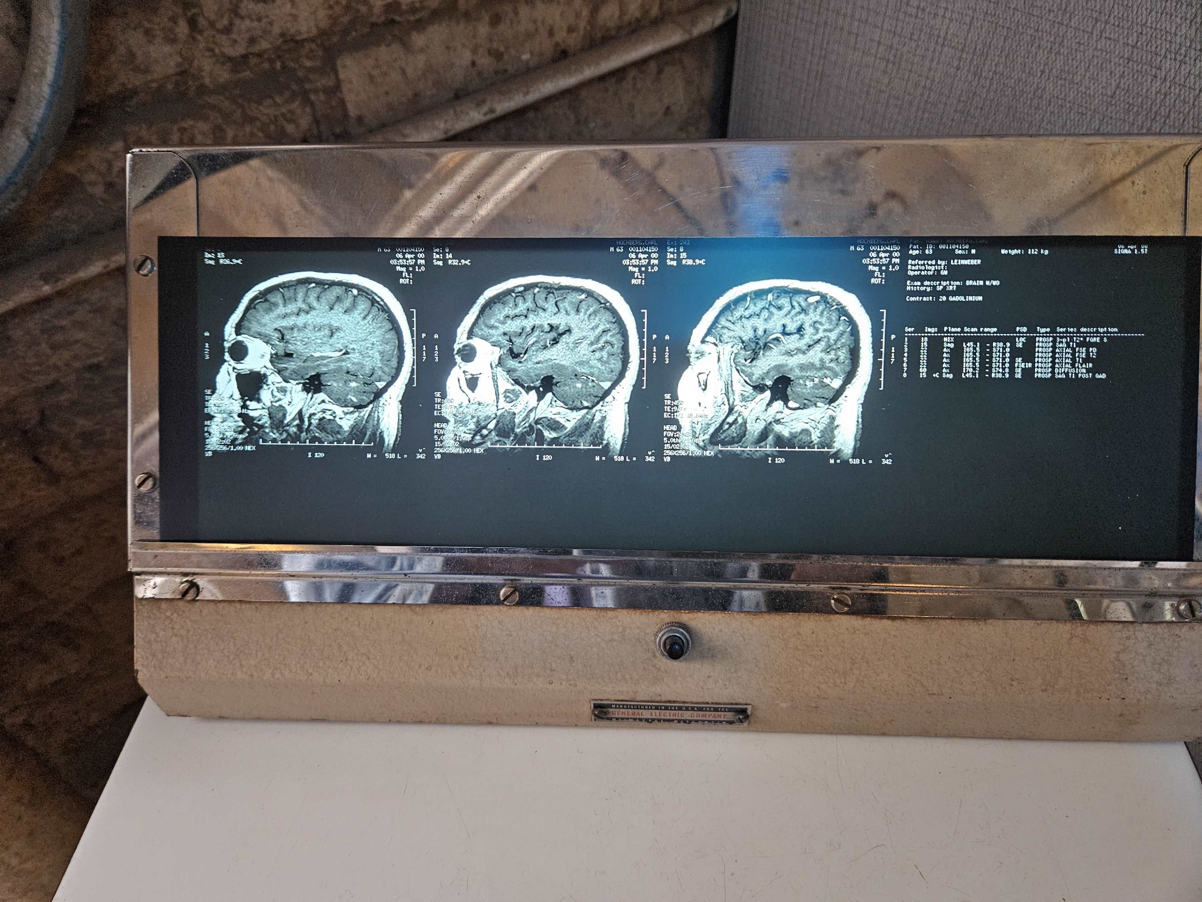 The image shows a display panel featuring three MRI scans of a human brain.
